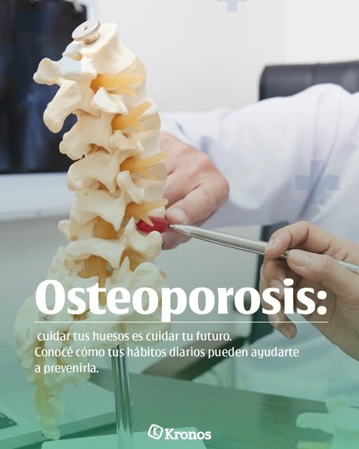 Osteoporosis: cuidar tus huesos es cuidar tu futuro